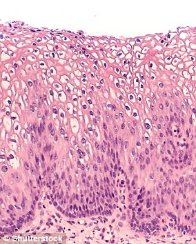 حداکثر هشت نفر از 10 نفر در زندگی خود به HPV آلوده خواهند شد