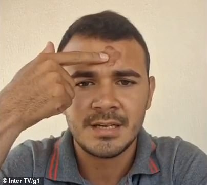 جکسون به جایی که کشیش محلی خود در روز اول عید خاکستر سنتی را به کار برد ، اشاره کرد ، اما این مارک اندکی پس از قرار گرفتن روی سرش شروع به سوزاندن پوست خود کرد