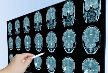 ماده مخفی در غذای و لباس های شما که ظهور زوال عقل را در ایالات متحده توضیح می دهد